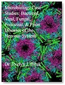 Microbiology Case Studies: Bacterial, Viral, Fungal, Protozoal, and Prion Diseases of the Nervous System