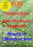 Acne Treatment and Cure - With the power of nature! Super fast results!
