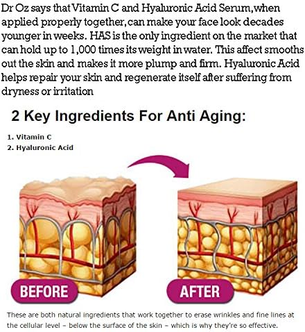 Retinol Moisturizer with Hyaluronic Acid ~ Clearance Sale