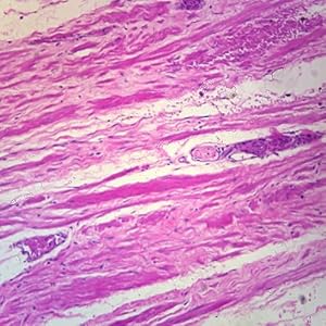 Human Prostate Gland - Young, sec. 7 um, H&E