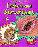 Itches and scratches