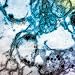 Coagulation