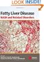 Fatty Liver Disease: NASH and Related Disorders