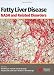 Fatty Liver Disease: NASH and Related Disorders