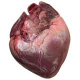 Heart Disease Calculator