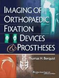 Imaging Of Orthopaedic Fixation Devices And Prostheses