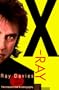 X-Ray: The Unauthorized Autobiography