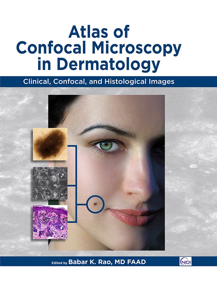 Atlas of Confocal Microscopy in Dermatology: Babar K. Rao ...