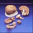 Budget Brain With Arteries Model