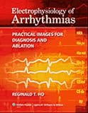 Electrophysiology Of Arrhythmias Practical Images For Diagnosis And Ablation
