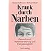 Krank durch Narben: Gesund durch Narbenentst�rung und Energieausgleich