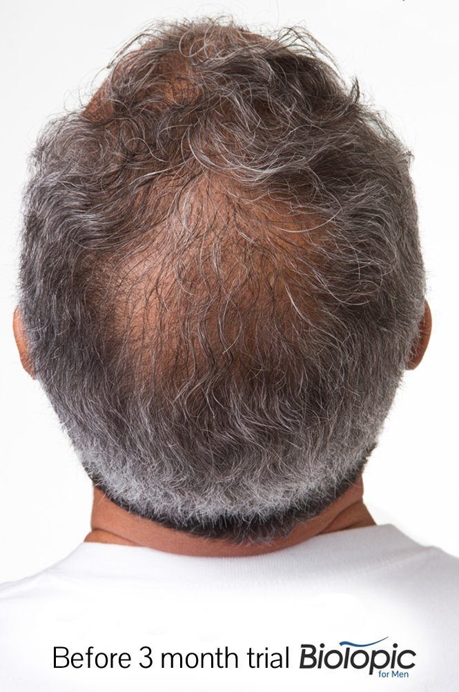 Amazon.com: Biotopic, FolliclePLUS 27 | Natural Biotin Hair Growth ...