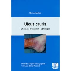 Ulcus Cruris. Erkennen - Behandeln - Vorbeugen