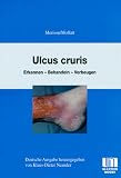 Ulcus Cruris. Erkennen - Behandeln - Vorbeugen