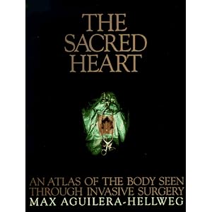 Click here to buy The Sacred Heart: An Atlas of the Body Seen Through Invasive Surgery by Max, M.D. Aguilera-Hellweg.