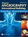 All Products : Abrams' Angiography: Interventional Radiology