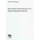 Removable Partial Dentures on Osseointegrated Implants by Christian Besimo