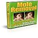 Mole and Wart Removal!
