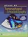 Atlas Of Transesophageal Echocardiography