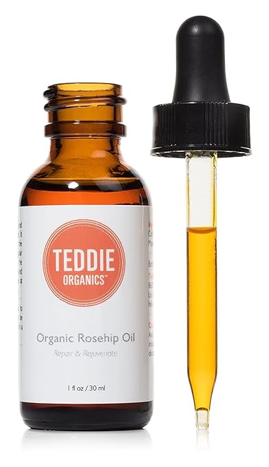 rosehip oil for redness