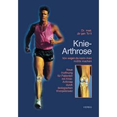 Knie-arthrose - von wegen da kann man nichts machen