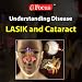 LASIK & Cataract