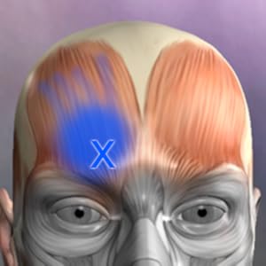 Amazon.com: Muscle Trigger Point Anatomy: Appstore for Android