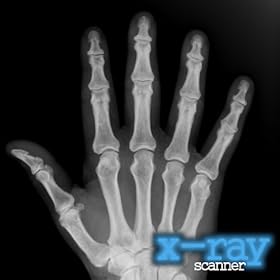 X-Ray Scanner