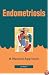 Endometriosis: A Natural Approach