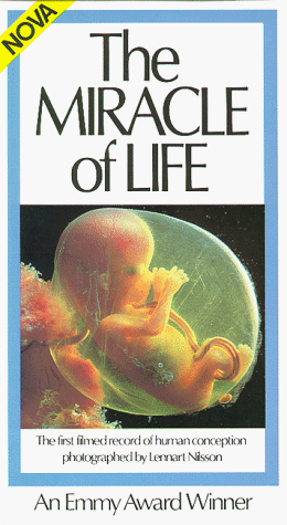 Nova - The Miracle of Life