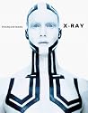 X-Ray