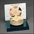 Skin Cancer Model