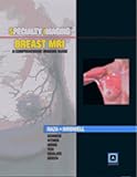 Specialty Imaging&Atilde;�&Acirc;&cent;&Atilde;&cent;&Atilde;�&Acirc;&cent;: Breast Mri A Comprehensive Imaging Guidepublished By Amirsys