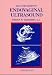 Endovaginal Ultrasound, 2nd Edition
