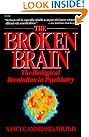 The Broken Brain...