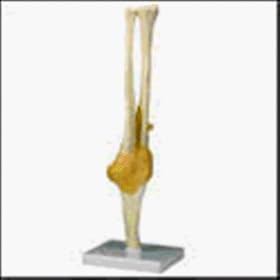 Functional Elbow Joint Model