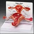 Uterus Ovary Model With Pathologies