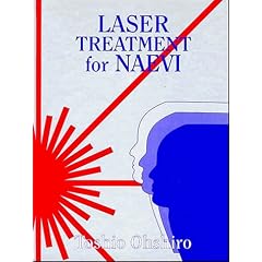 Laser Treatment for Naevi