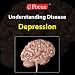 Depression