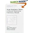 Acute Respiratory Failure in Chronic Obstructive Pulmonary Disease (Lung Biology in Health and... by Derenne