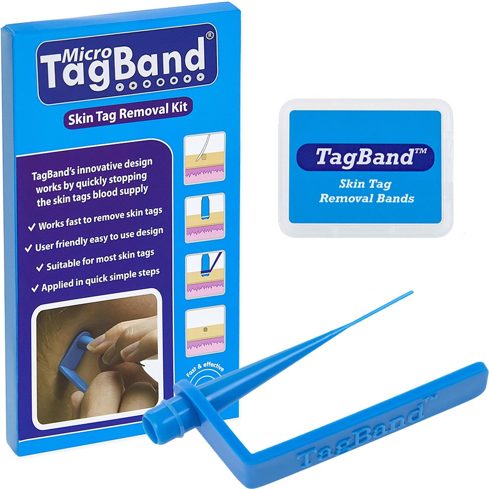 Micro TagBand Skin Tag Remover Device for Small to Medium