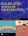 Age-related Macular Degeneration A Comprehensive Textbook