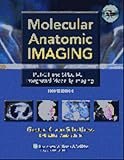 Molecular Anatomic Imaging Pet-ct And Spect-ct Integrated Modality Imaging