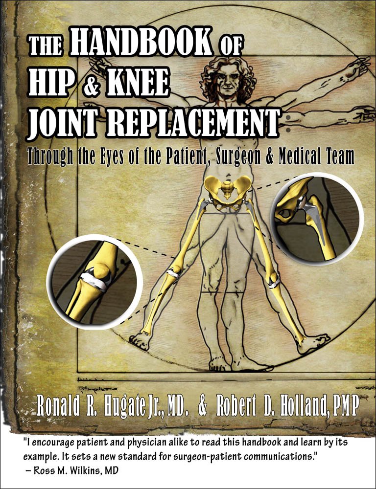 Amazon.com: Handbook of Hip & Knee Joint Replacement: Through the ... Amazon.com: Handbook of Hip & Knee Joint Replacement: Through the ...