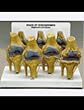4-Stage Osteoarthritis Model