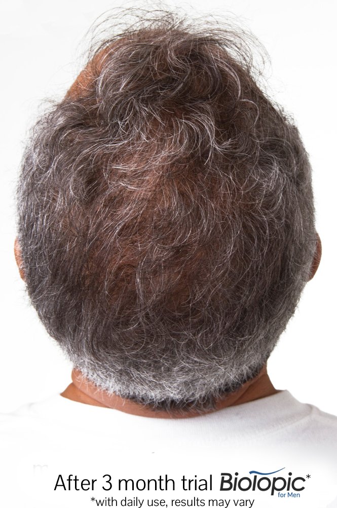 Amazon.com: Biotopic, FolliclePLUS 27 | Natural Biotin Hair Growth ...