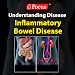 (IBD) Inflammatory Bowel Disease
