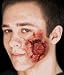 Open Wound Kit
