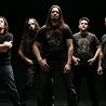 Image of Anthrax