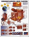 Understanding Skin Cancer Anatomical Chart 71xETrpRwAL. SL160 Understanding Skin Cancer Anatomical Chart